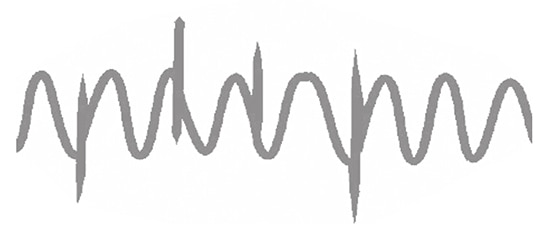 Transients are substantial increases in voltage Image of transients are substantial increases in voltage