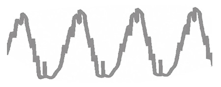 Electrical noise produces rapid voltage variations Image of electrical noise produces rapid voltage variations