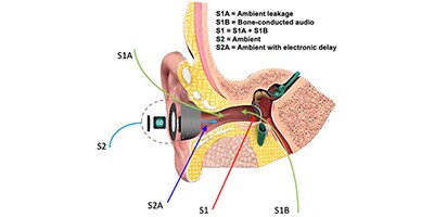 Cross Section of an ear canal with hearing aid device