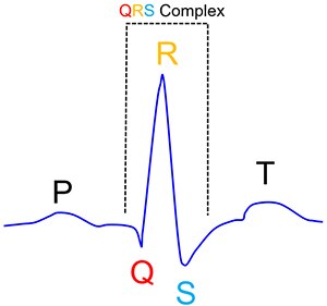 Q 點、R 點和 S 點構成 QRS 複合波的示意圖