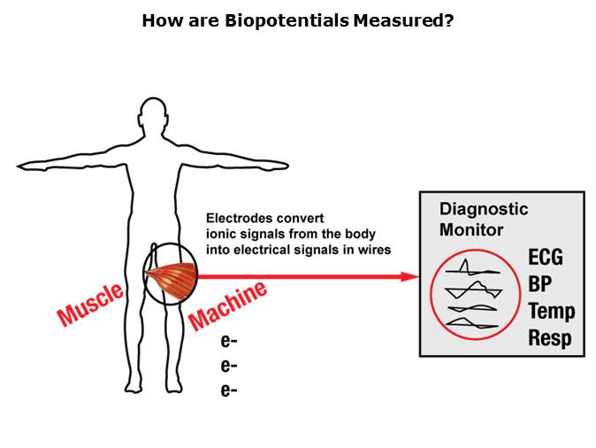 Medical ECG Slide 5