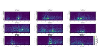Image of Low-Cost, Power Efficient EMG Prosthetic Hand (Part 2)